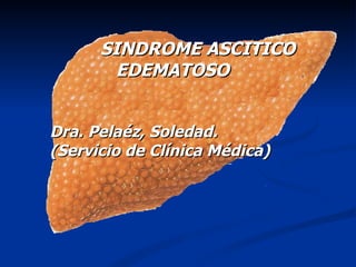 SINDROME ASCITICO
        EDEMATOSO


Dra. Pelaéz, Soledad.
(Servicio de Clínica Médica)
 