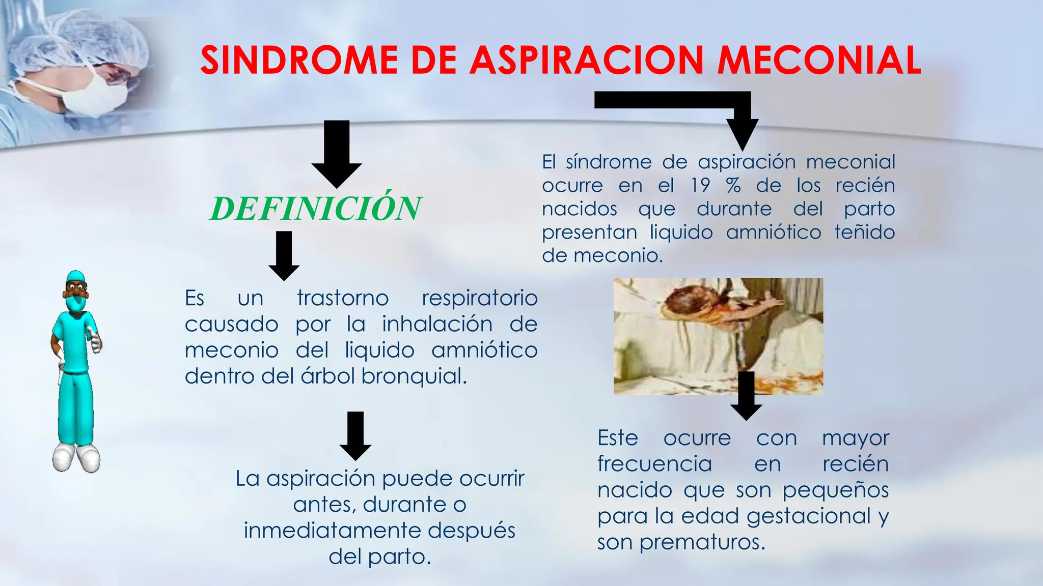 SINDROME ASPIRACION DE MECONIO EN RECIEN NACIDO POSTERMINO | PDF