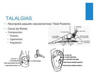 TALALGIAS
• - Neuropatía paquete vasculonervioso Tibial Posterior.
• - Canal de Richet.
• Composición:
• Huesos.
• Ligamentos.
• Angulación