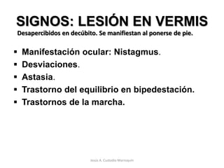 SINDROME CEREBELOSOJesús A. Custodio Marroquín