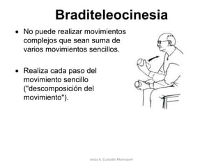 Al movilizar las extremidades se producen movimientos excesivos de las articulaciones terminales.