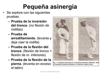 Cuando el individuo afectado camina se inclina y se tambalea hacia el lado afectado.Jesús A. Custodio Marroquín