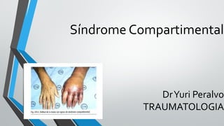 Síndrome Compartimental
DrYuri Peralvo
TRAUMATOLOGIA
 