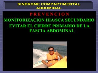 P R E V E N C I O N MONITORIZACION HIA/SCA SECUNDARIO EVITAR EL CIERRE PRIMARIO DE LA FASCIA ABDOMINAL SINDROME COMPARTIMENTAL ABDOMINAL 