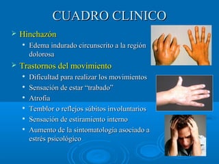 CCUUAADDRROO CCLLIINNIICCOO 
 HHiinncchhaazzóónn 
 EEddeemmaa iinndduurraaddoo cciirrccuunnssccrriittoo aa llaa rreeggiióónn 
ddoolloorroossaa 
 TTrraassttoorrnnooss ddeell mmoovviimmiieennttoo 
 DDiiffiiccuullttaadd ppaarraa rreeaalliizzaarr llooss mmoovviimmiieennttooss 
 SSeennssaacciióónn ddee eessttaarr ““ttrraabbaaddoo”” 
 AAttrrooffiiaa 
 TTeemmbblloorr oo rreefflleejjooss ssúúbbiittooss iinnvvoolluunnttaarriiooss 
 SSeennssaacciióónn ddee eessttiirraammiieennttoo iinntteerrnnoo 
 AAuummeennttoo ddee llaa ssiinnttoommaattoollooggííaa aassoocciiaaddoo aa 
eessttrrééss ppssiiccoollóóggiiccoo 
 