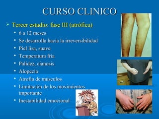 CCUURRSSOO CCLLIINNIICCOO 
 TTeerrcceerr eessttaaddiioo:: ffaassee IIIIII ((aattrróóffiiccaa)) 
 66 aa 1122 mmeesseess 
 SSee ddeessaarrrroollllaa hhaacciiaa llaa iirrrreevveerrssiibbiilliiddaadd 
 PPiieell lliissaa,, ssuuaavvee 
 TTeemmppeerraattuurraa ffrrííaa 
 PPaalliiddeezz,, cciiaannoossiiss 
 AAllooppeecciiaa 
 AAttrrooffiiaa ddee mmúússccuullooss 
 LLiimmiittaacciióónn ddee llooss mmoovviimmiieennttooss 
iimmppoorrttaannttee 
 IInneessttaabbiilliiddaadd eemmoocciioonnaall 
 