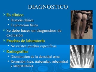 DDIIAAGGNNOOSSTTIICCOO 
 EEss ccllíínniiccoo 
 HHiissttoorriiaa ccllíínniiccaa 
 EExxpplloorraacciióónn ffííssiiccaa 
 SSee ddeebbee hhaacceerr uunn ddiiaaggnnoossttiiccoo ddee 
eexxcclluussiióónn 
 PPrruueebbaass ddee llaabboorraattoorriioo 
 NNoo eexxiisstteenn pprruueebbaass eessppeecciiffiiccaass 
 RRaaddiiooggrraaffííaass 
 DDiissmmiinnuucciióónn ddee llaa ddeennssiiddaadd óósseeaa 
 RReessoorrssiióónn óósseeaa,, ttrraabbeeccuullaarr,, ssuubbccoonnddrraall 
yy ssuubbppeerriioossttiiccaa 
 