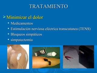 TTRRAATTAAMMIIEENNTTOO 
MMiinniimmiizzaarr eell ddoolloorr 
 MMeeddiiccaammeennttooss 
 EEssttiimmuullaacciióónn nneerrvviioossaa eellééccttrriiccaa ttrraannssccuuttaanneeaa ((TTEENNSS)) 
 BBllooqquueeooss ssiimmppááttiiccooss 
 ssiimmppaatteeccttoommiiaa 
 