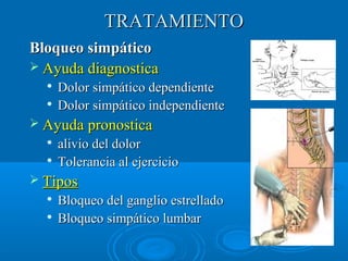 TTRRAATTAAMMIIEENNTTOO 
BBllooqquueeoo ssiimmppááttiiccoo 
 AAyyuuddaa ddiiaaggnnoossttiiccaa 
 DDoolloorr ssiimmppááttiiccoo ddeeppeennddiieennttee 
 DDoolloorr ssiimmppááttiiccoo iinnddeeppeennddiieennttee 
 AAyyuuddaa pprroonnoossttiiccaa 
 aalliivviioo ddeell ddoolloorr 
 TToolleerraanncciiaa aall eejjeerrcciicciioo 
 TTiippooss 
 BBllooqquueeoo ddeell ggaanngglliioo eessttrreellllaaddoo 
 BBllooqquueeoo ssiimmppááttiiccoo lluummbbaarr 
 