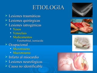 EETTIIOOLLOOGGIIAA 
 LLeessiioonneess ttrraauummááttiiccaass 
 LLeessiioonneess qquuiirrúúrrggiiccaass 
 LLeessiioonneess iiaattrrooggéénniiccaass 
 YYeessooss 
 VVeennoocclliissiiss 
 MMeeddiiccaammeennttooss 
• FFeennoobbaarrbbiittaall,, iissoonniiaacciiddaa 
 OOccuuppaacciioonnaall 
 MMiiccrroottrraauummaa 
 MMaaccrroottrraauummaa 
 IInnffaarrttoo aall mmiiooccaarrddiioo 
 LLeessiioonneess nneeuurroollóóggiiccaass 
 CCaauussaa nnoo iiddeennttiiffiiccaabbllee 
 