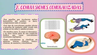 -Son aquellas que involucran ambos
hemisferios del cerebro, es decir,
comprometen todo el cuerpo.
-Este tipo de convulsiones pueden afectar
a personas de cualquier edad, siendo más
común en los niños y adultos jóvenes.
-En muchos casos, la causa se desconoce,
y en otros forma parte de una condición
médica que causa convulsiones
recurrentes (epilepsia).
-Estas convulsiones se clasifican en
atónicas, tónicas, clónicas, tónico-
clónicas, de ausencia y mioclónicas.
2. CONVULSIONES GENERALIZADAS
 