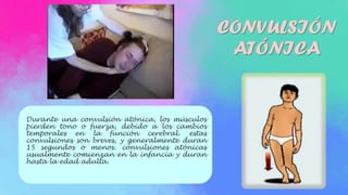 CONVULSIÓN
ATÓNICA
Durante una convulsión atónica, los músculos
pierden tono o fuerza, debido a los cambios
temporales en la función cerebral. estas
convulsiones son breves, y generalmente duran
15 segundos o menos. convulsiones atónicas
usualmente comienzan en la infancia y duran
hasta la edad adulta.
 