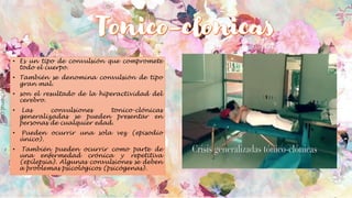 • Es un tipo de convulsión que compromete
todo el cuerpo.
• También se denomina convulsión de tipo
gran mal.
• son el resultado de la hiperactividad del
cerebro.
• Las convulsiones tonico-clónicas
generalizadas se pueden presentar en
personas de cualquier edad.
• Pueden ocurrir una sola vez (episodio
único).
• También pueden ocurrir como parte de
una enfermedad crónica y repetitiva
(epilepsia). Algunas convulsiones se deben
a problemas psicológicos (psicógenas).
 