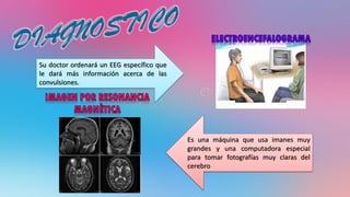 Su doctor ordenará un EEG específico que
le dará más información acerca de las
convulsiones.
Es una máquina que usa imanes muy
grandes y una computadora especial
para tomar fotografías muy claras del
cerebro
 
