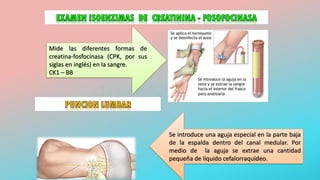 Mide las diferentes formas de
creatina-fosfocinasa (CPK, por sus
siglas en inglés) en la sangre.
CK1 – BB
Se introduce una aguja especial en la parte baja
de la espalda dentro del canal medular. Por
medio de la aguja se extrae una cantidad
pequeña de líquido cefalorraquídeo.
 