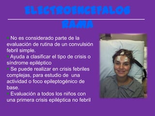 ELECTROENCEFALOG
              RAMA
 No es considerado parte de la
evaluación de rutina de un convulsión
febril simple.
 Ayuda a clasificar el tipo de crisis o
síndrome epiléptico
 Se puede realizar en crisis febriles
complejas, para estudio de una
actividad o foco epileptogénico de
base.
 Evaluación a todos los niños con
una primera crisis epiléptica no febril
 