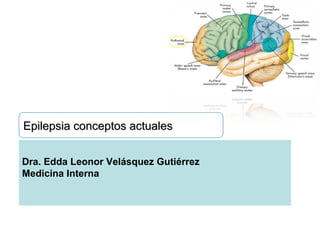 Epilepsia conceptos actualesEpilepsia conceptos actuales
Dra. Edda Leonor Velásquez Gutiérrez
Medicina Interna
 