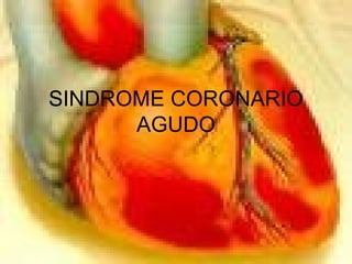 SINDROME CORONARIO
AGUDO
 