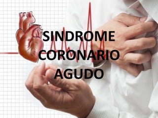 SINDROME
CORONARIO
AGUDO
 