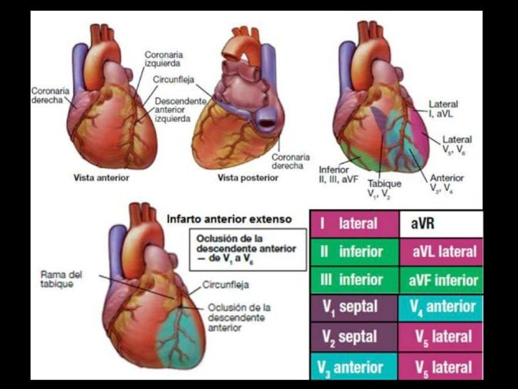 Caras Del Corazón Ecg Y Arterias es.slideshare.net