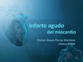 del miocardio
Doctor Álvaro Porras Martínez
Clínica SOMA
Infarto agudo
 