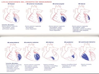 Arritmias: guía practica para le interpretación y tratamiento, 3 edición, sección V, Pág. 4
 