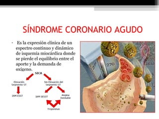 SÍNDROME CORONARIO AGUDO
• Es la expresión clínica de un
espectro continuo y dinámico
de isquemia miocárdica donde
se pierde el equilibrio entre el
aporte y la demanda de
oxígeno.
 