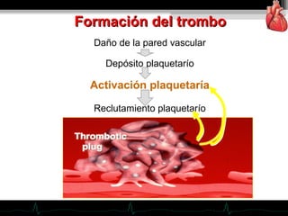 Formación del tromboFormación del trombo
Daño de la pared vascular
Depósito plaquetarío
Activación plaquetaría
Reclutamiento plaquetarío
 