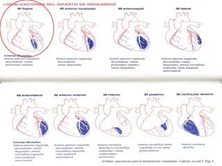Arritmias: guía practica para le interpretación y tratamiento, 3 edición, sección V, Pág. 4
 