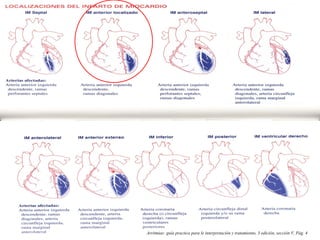 Arritmias: guía practica para le interpretación y tratamiento, 3 edición, sección V, Pág. 4
 