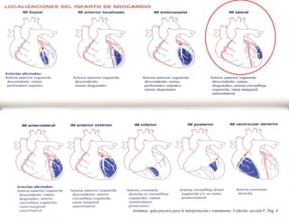 Arritmias: guía practica para le interpretación y tratamiento, 3 edición, sección V, Pág. 4
 