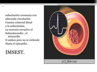 • INFARTO NO
TRANSMURAL.
suboclusión coronaria con
adecuada circulación
Común colateral distal
a la suboclusión.
La necrosis envuelve el
Subendocardio , el
miocardio
O ambos pero no se extiende
Hasta el epicardio.
IMSEST.
 