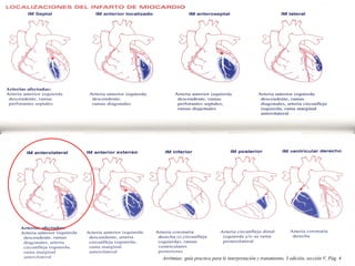 Arritmias: guía practica para le interpretación y tratamiento, 3 edición, sección V, Pág. 4
 