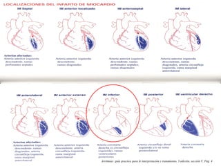 Arritmias: guía practica para le interpretación y tratamiento, 3 edición, sección V, Pág. 4
 