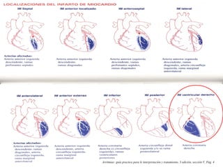Arritmias: guía practica para le interpretación y tratamiento, 3 edición, sección V, Pág. 4
 