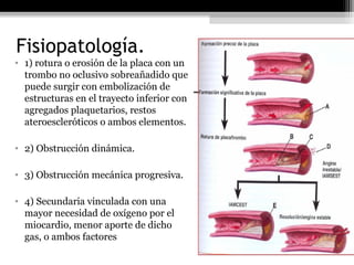 Fisiopatología.
• 1) rotura o erosión de la placa con un
trombo no oclusivo sobreañadido que
puede surgir con embolización de
estructuras en el trayecto inferior con
agregados plaquetarios, restos
ateroescleróticos o ambos elementos.
• 2) Obstrucción dinámica.
• 3) Obstrucción mecánica progresiva.
• 4) Secundaria vinculada con una
mayor necesidad de oxígeno por el
miocardio, menor aporte de dicho
gas, o ambos factores
 