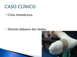 Cinta metatársica; Silicone debaixo dos dedos; 