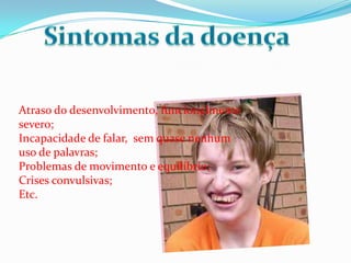 Atraso do desenvolvimento, funcionalmente
severo;
Incapacidade de falar, sem quase nenhum
uso de palavras;
Problemas de movimento e equilíbrio;
Crises convulsivas;
Etc.
 