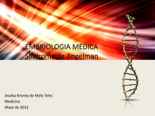EMBRIOLOGIA MÉDICA 
Síndrome de Angelman 
Jessika Krisnny de Melo Teles 
Medicina 
Mayo de 2013 
 