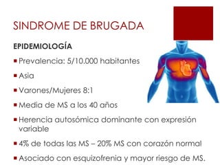 EPIDEMIOLOGÍA
 Prevalencia: 5/10.000 habitantes
 Asia
 Varones/Mujeres 8:1
 Media de MS a los 40 años
 Herencia autosómica dominante con expresión
variable
 4% de todas las MS – 20% MS con corazón normal
 Asociado con esquizofrenia y mayor riesgo de MS.
SINDROME DE BRUGADA
 