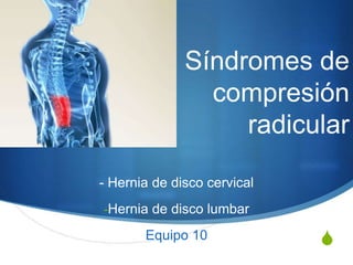 Síndromes de
                compresión
                   radicular

- Hernia de disco cervical
-Hernia de disco lumbar

       Equipo 10             S
 