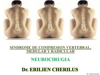 Dr. ERILIEN CHERILUS
SINDROME DE COMPRESION VERTEBRAL,
MEDULAR Y RADICULAR
.
NEUROCIRUGIA
Dr. Erilien Cherilus
 