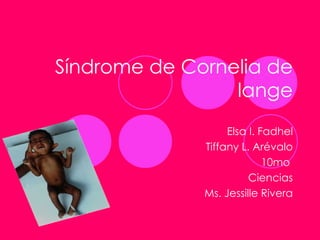 Síndrome de Cornelia de lange Elsa I. Fadhel Tiffany L. Arévalo 10mo  Ciencias Ms. Jessille Rivera 