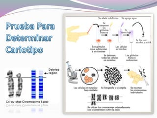 Sindrome de cri du chat