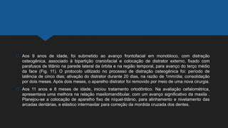  Aos 9 anos de idade, foi submetido ao avanço frontofacial em monobloco, com distração
osteogênica, associado à bipartição craniofacial e colocação de distrator externo, fixado com
parafusos de titânio na parede lateral da órbita e na região temporal, para avanço do terço médio
da face (Fig. 11). O protocolo utilizado no processo de distração osteogênica foi: período de
latência de cinco dias; ativação do distrator durante 20 dias, na razão de 1mm/dia; consolidação
por dois meses. Após dois meses, o aparelho distrator foi removido por meio de uma nova cirurgia.
 Aos 11 anos e 8 meses de idade, iniciou tratamento ortodôntico. Na avaliação cefalométrica,
apresentava uma melhora na relação maxilomandibular, com um avanço significativo da maxila .
Planejou-se a colocação de aparelho fixo de níquel-titânio, para alinhamento e nivelamento das
arcadas dentárias, e elástico intermaxilar para correção da mordida cruzada dos dentes.
 