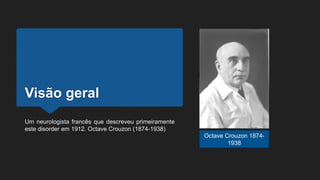 Visão geral
Um neurologista francês que descreveu primeiramente
este disorder em 1912. Octave Crouzon (1874-1938)
Octave Crouzon 1874-
1938
 