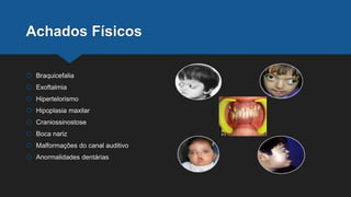 Achados Físicos
 Braquicefalia
 Exoftalmia
 Hipertelorismo
 Hipoplasia maxilar
 Craniossinostose
 Boca nariz
 Malformações do canal auditivo
 Anormalidades dentárias
 