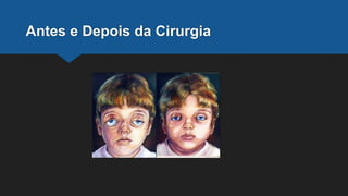 Antes e Depois da Cirurgia
 