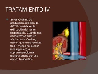 TRATAMIENTO IV
   Sd de Cushing de
    producción ectópica de
    ACTH consiste en la
    extirpación del tumor
    responsable. Cuando nos
    encontramos ante un
    síndrome de Cushing
    oculto( que no se localiza
    tras 6 meses de intensa
    investigación) la
    suprarrenalectomía
    bilateral puede ser una
    opción terapeútica
 