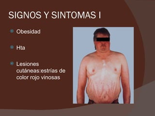 SIGNOS Y SINTOMAS I
   Obesidad

   Hta

   Lesiones
    cutáneas:estrías de
    color rojo vinosas
 